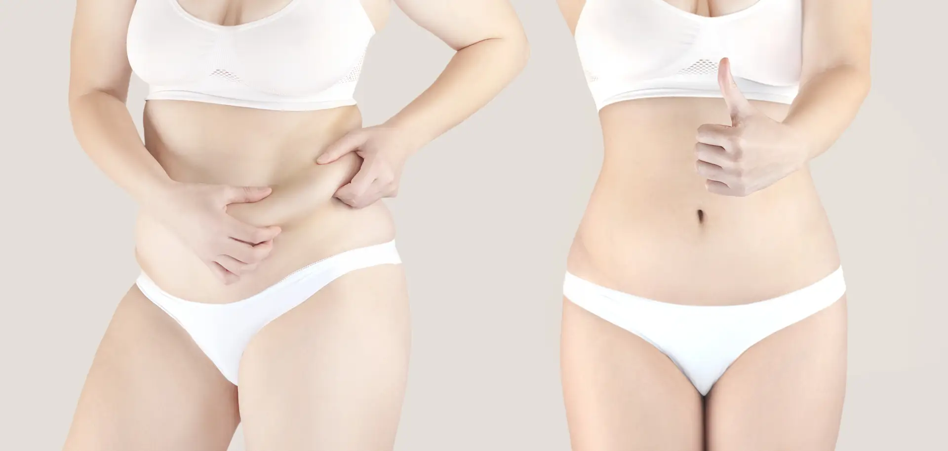 Tummy Tuck vs Liposuction