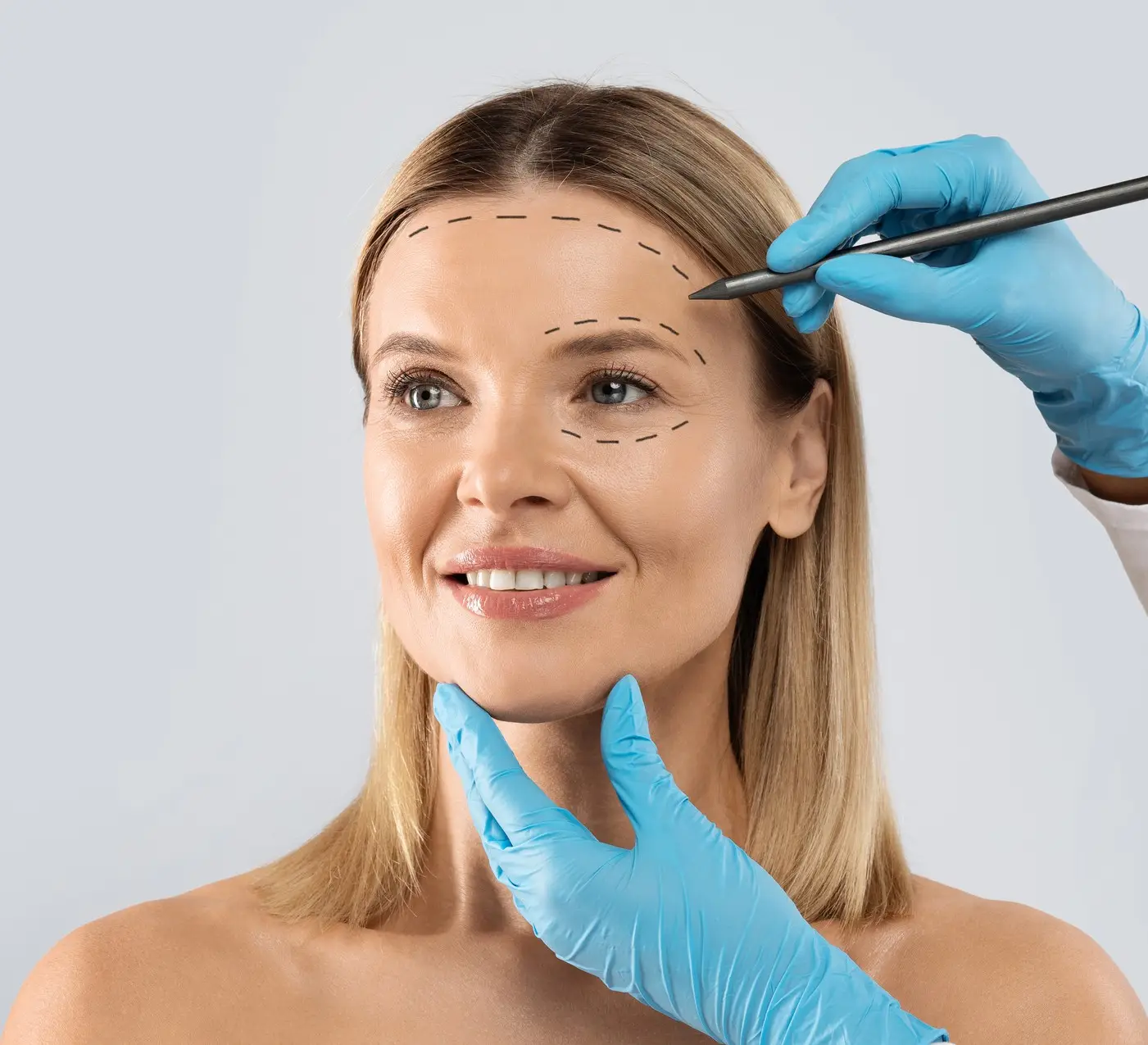 Facial fat transfer with nano fat